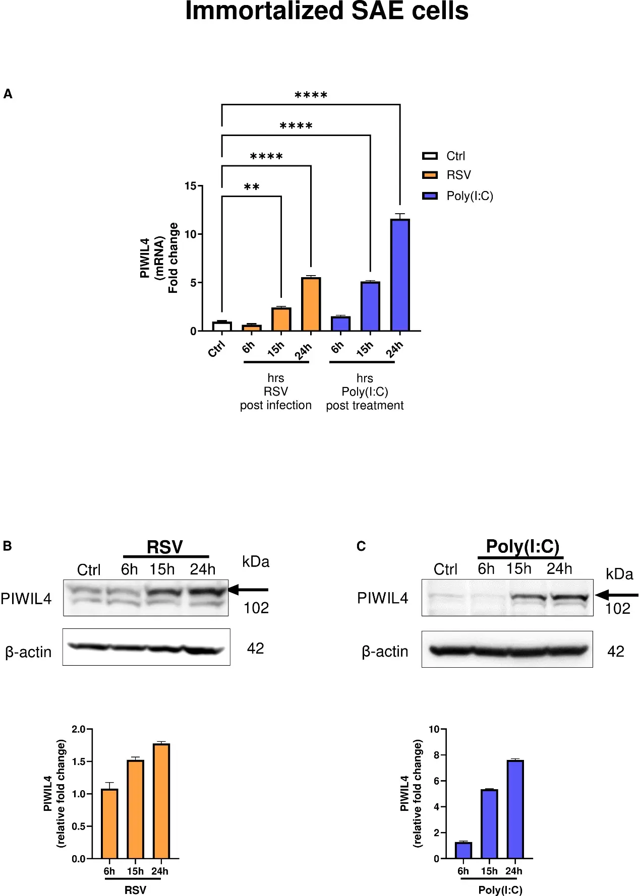 Changes in PIWIL4 expression and cellular localization in airway epithelial cells following RSV infection.