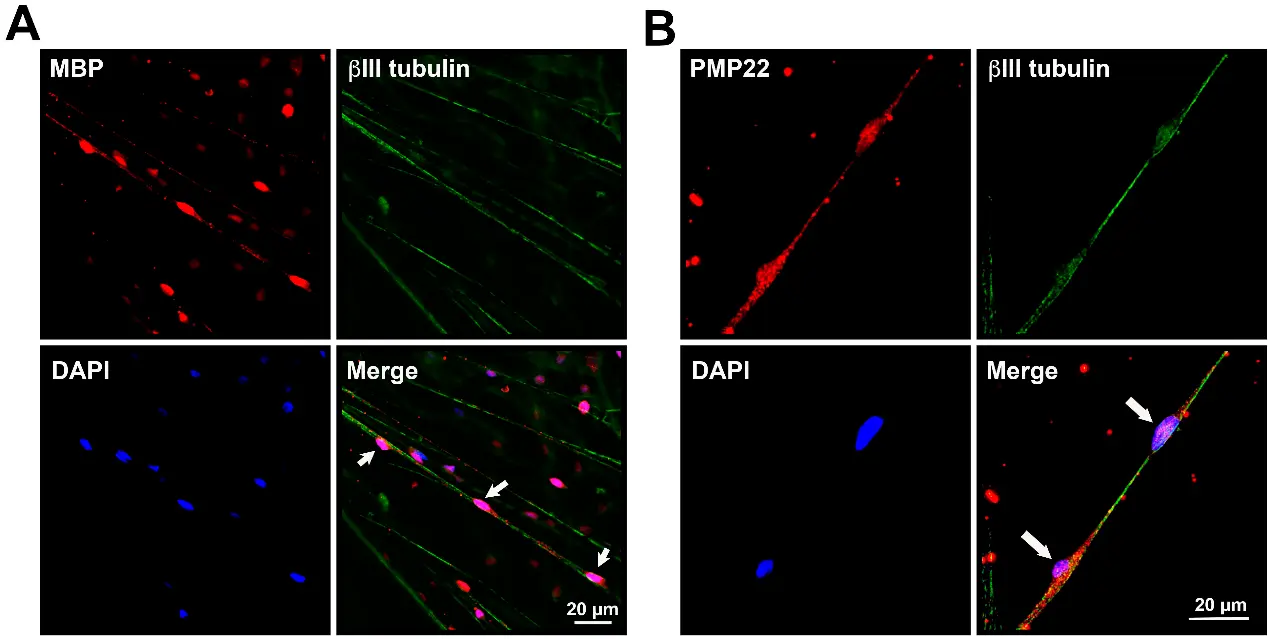 Myelin formation was demonstrated by MBP (A)—or PMP22 (B)—positive IFRS1 cells (red) surrounding βIII tubulin-positive neurites (green). Nuclei were stained blue with DAPI. Myelin-like segmental structures are indicated as arrows in the Merge pictures.
