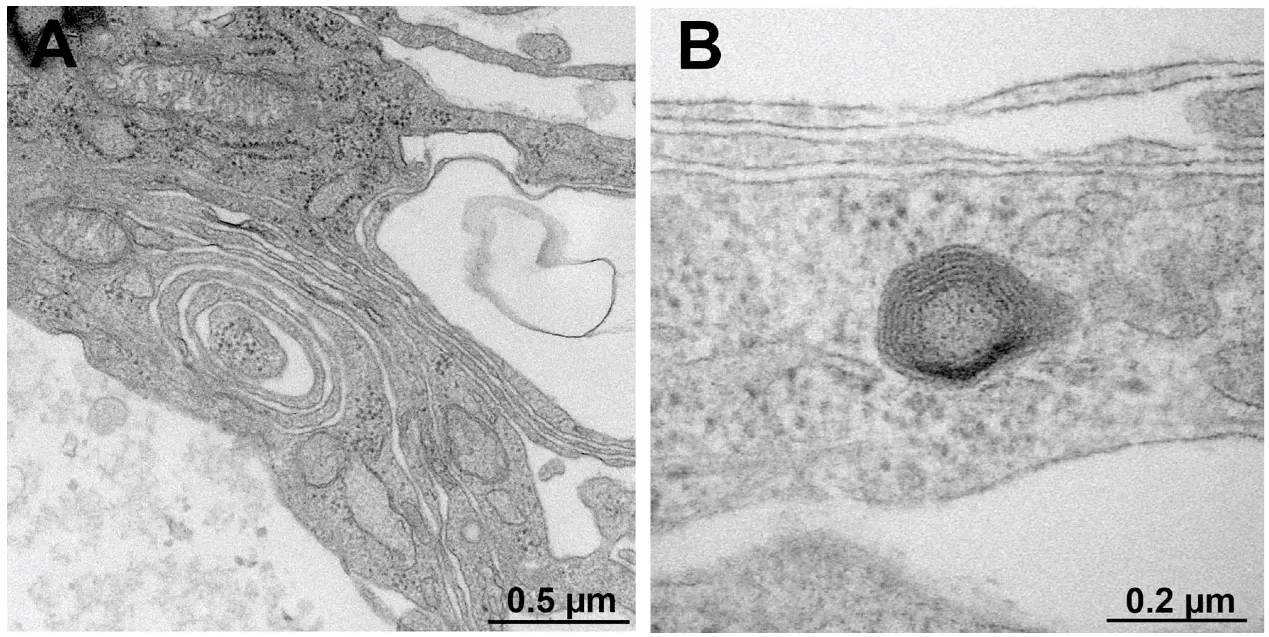 Representative electron micrograph of transversely sectioned promyelinating (A) and myelinating (B) structures in ND7/23-IFRS1 cells at 28 days of co-culturing.