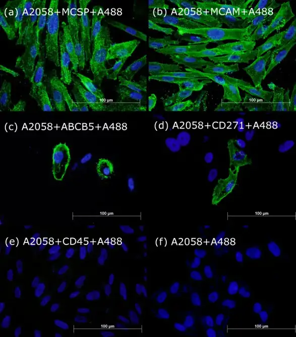 Immunofluorescent analysis of A2058 melanoma cells.