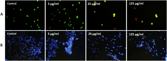 AO/PI staining analyses show that ZCD-NPs induce significant cytotoxic effects in A2780 cells, as evidenced by decreased green and increased red. DAPI staining further confirms a dose-dependent increase in nuclear condensation and fragmentation, characteristic of apoptosis.