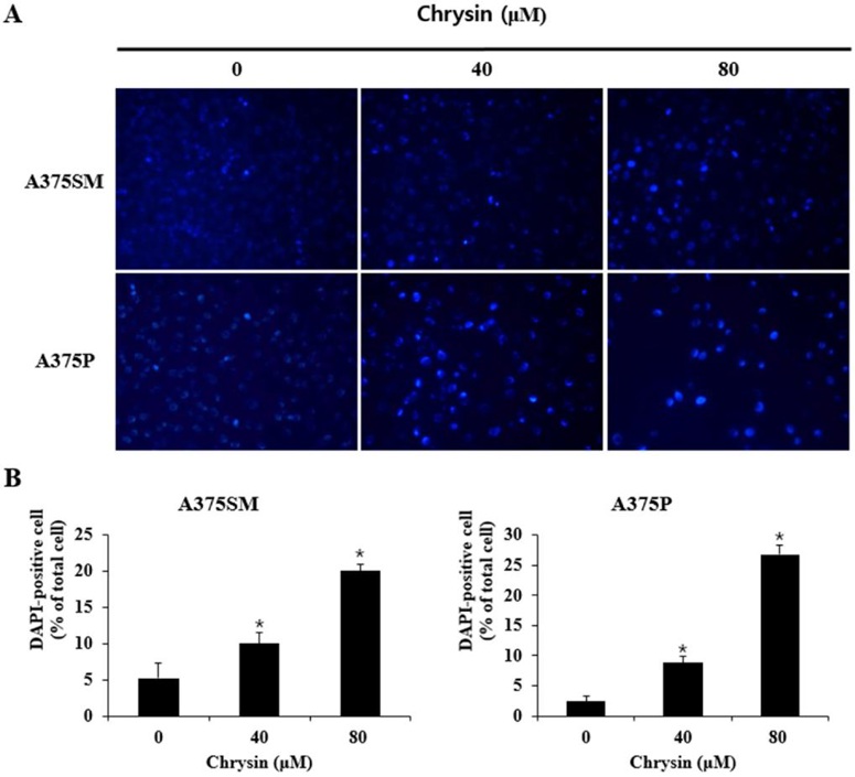 Chrysin induces apoptotic body formation in A375SM and A375P human melanoma cancer cells.