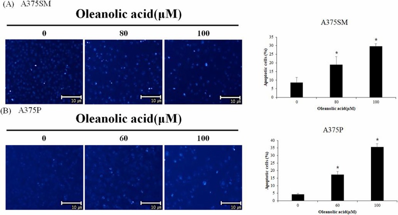 Oleanolic acid induced apoptotic body of A375SM and A375P cells.