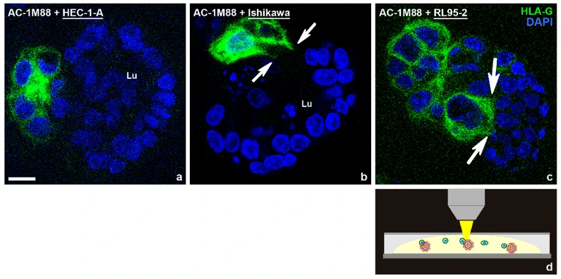 Three-dimensional invasion assay: Human trophoblast-endometrial interaction of trophoblast-derived AC-1M88 cells specifically stained with the human histocompatibility antigen (HLA-G, green) with spheroids of different polarity from the basal cell pole side after 9 days in Matrigel.