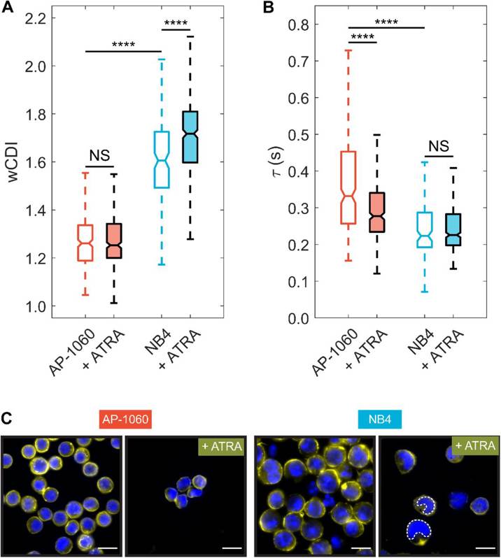 APL cell responses to all-trans retinoic acid (ATRA).