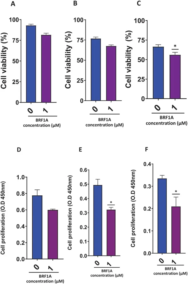 Dose and time-dependent effect of BRF1A on cell viability and proliferation of IgG-producing myeloma cells (ARH77 cells).