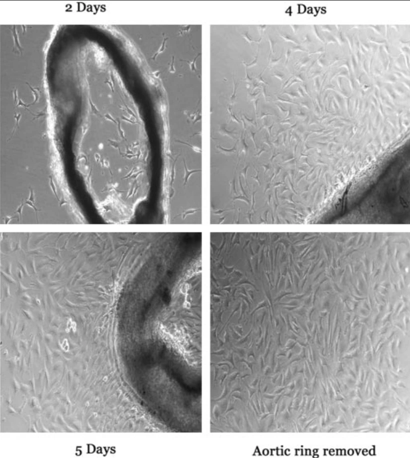 Isolation and culture of mouse aortic endothelial cells (MAEC).