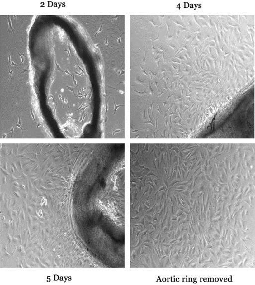 Isolation and culture of mouse aortic endothelial cells (MAEC)