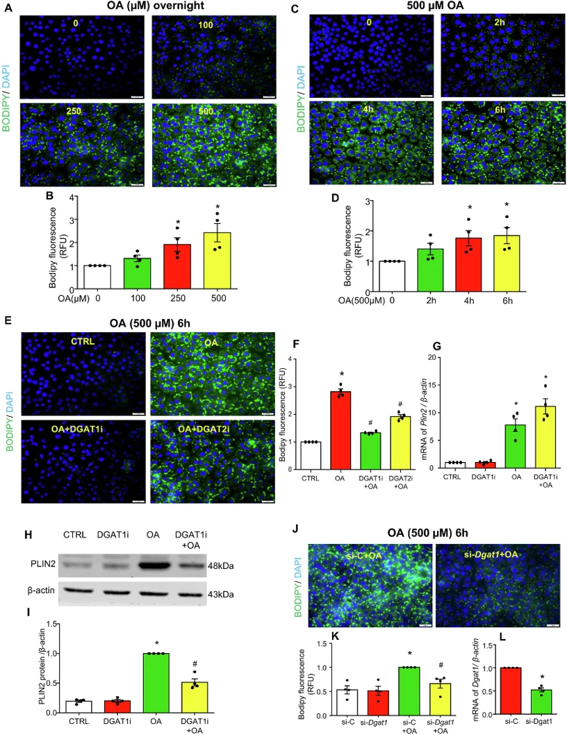 OA induces LD formation via DGAT1 in cultured MCECs.