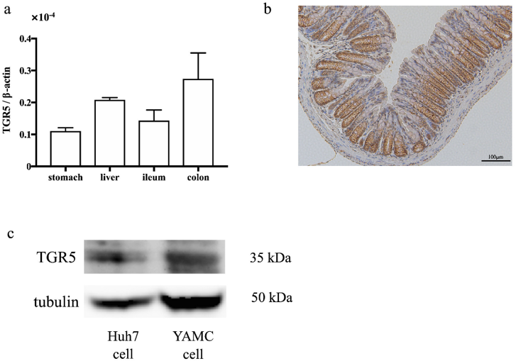TGR5 is expressed in the colonic epithelium.