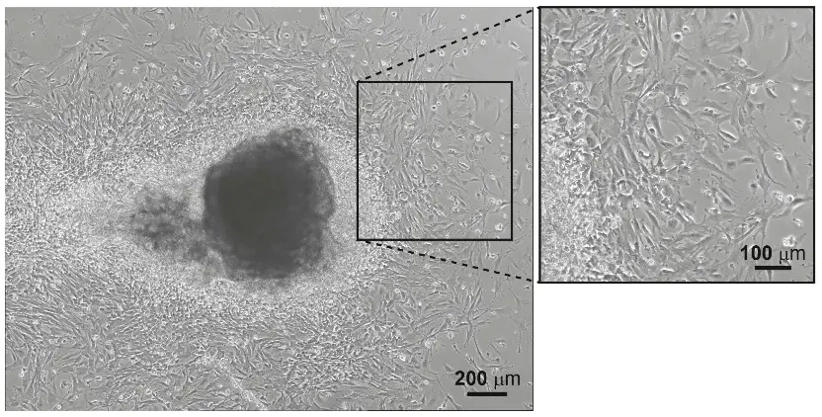 Light microscopy image of lung fibroblasts crawling-out from lung tissue pieces (left) and higher magnification image (right).