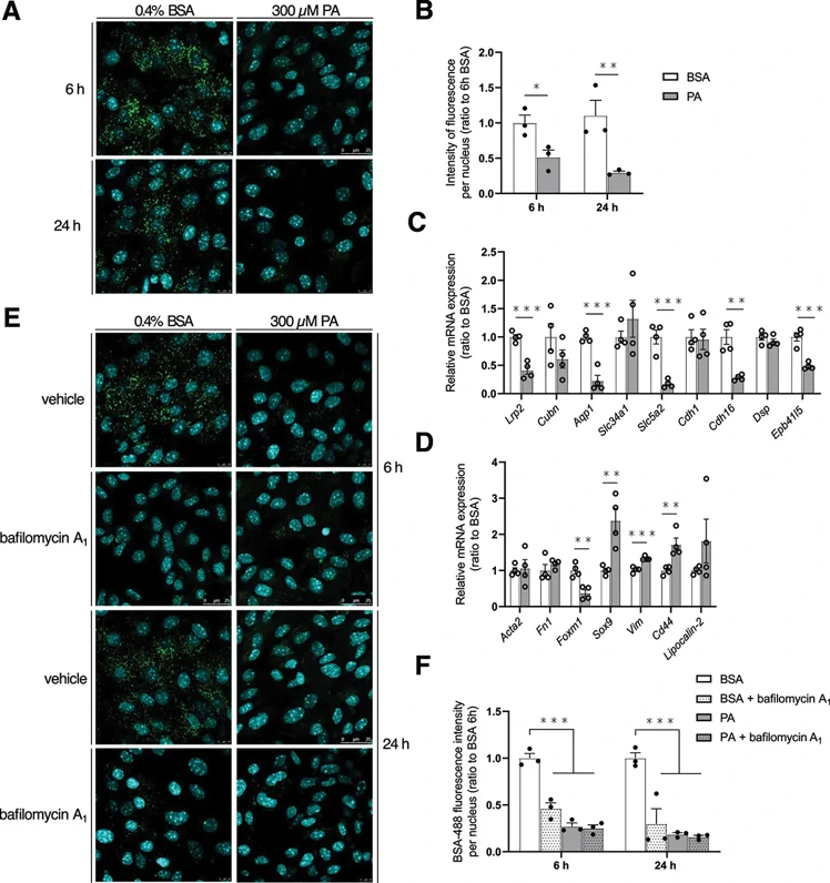The PA-induced lysosomal dysfunction drives MmPTEC dedifferentiation while AMPK activation is protective.