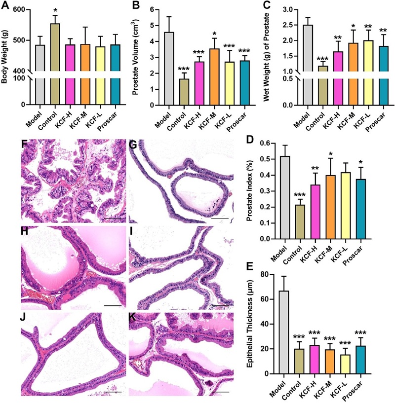 1.Fig.1: Effects of KCF and Proscar on body weight, prostate size, and histology in BPH rats (H&E, ×200).