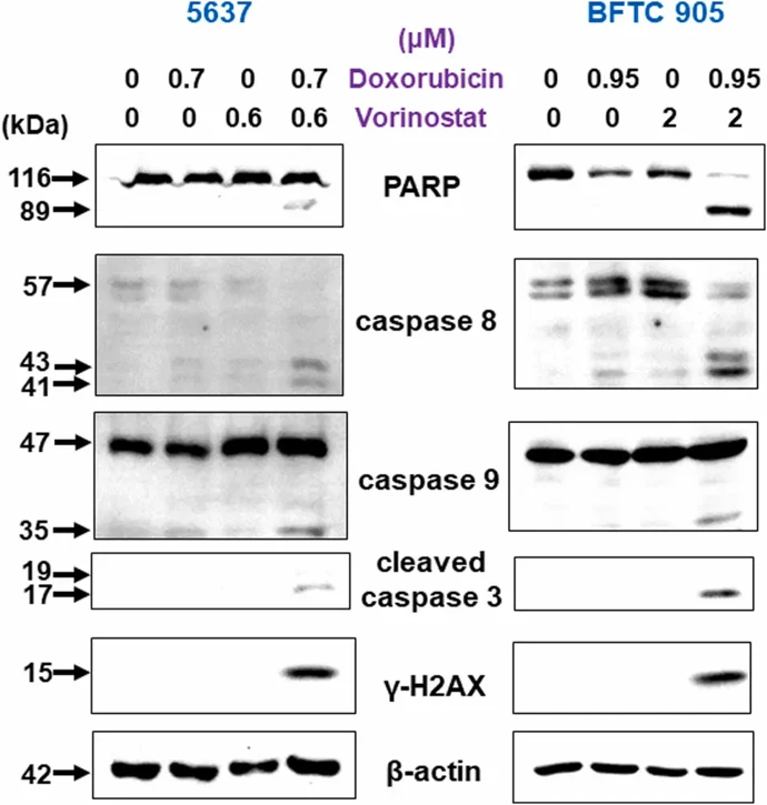 Synergistic Cytotoxicity of Combined Doxorubicin with Vorinostat Against 5637 and BFTC 905 Cells.