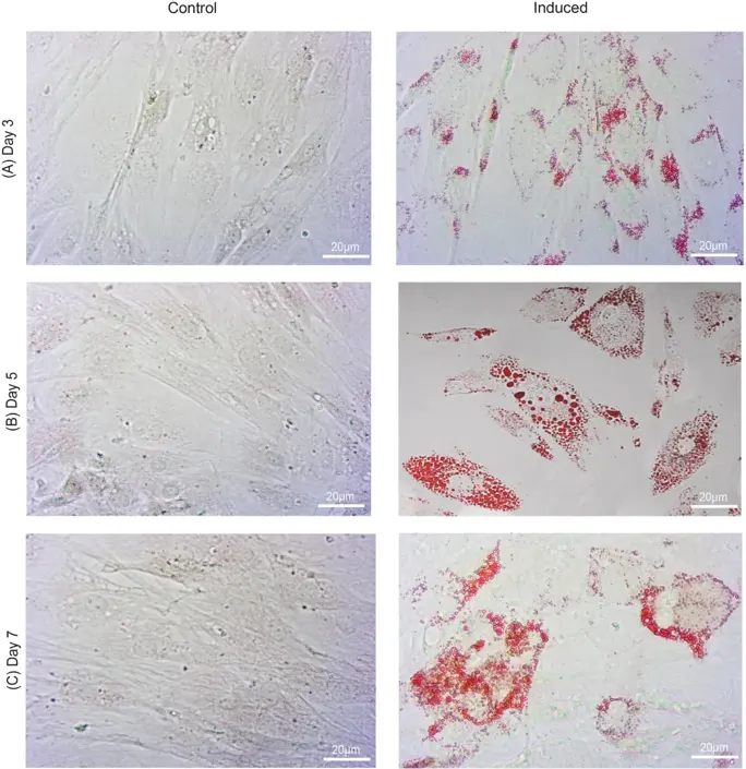 Morphological changes and lipid accumulation during adipocyte differentiation.
