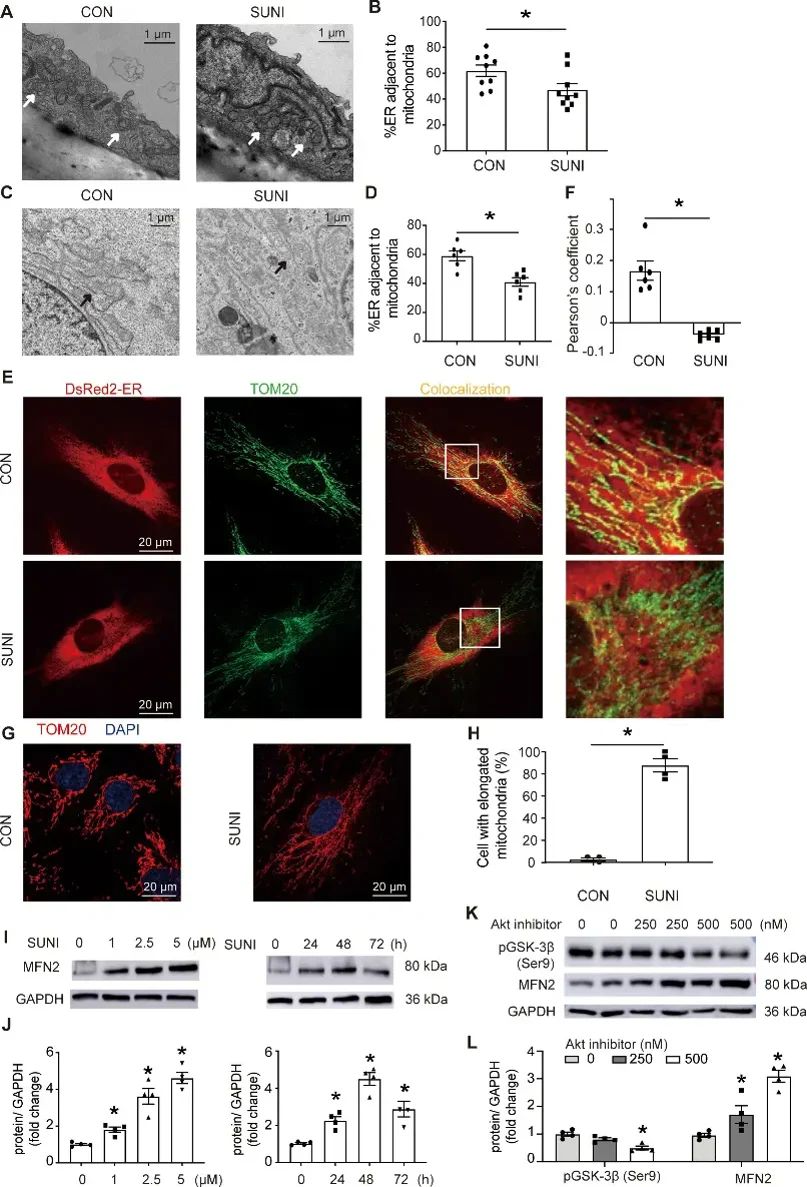 Sunitinib induces reduction in MAMs, mitochondrial elongation, and increases mitofusin 2 expression in ECs.