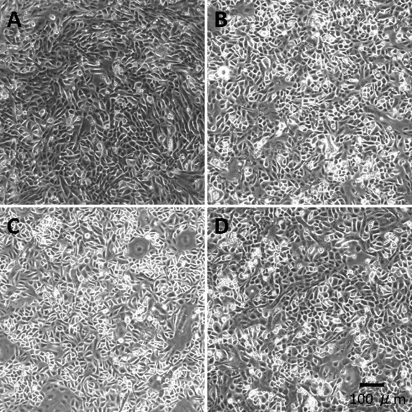 Phase contrast photomicrographs of mouse corneal epithelial cells (MCECs).