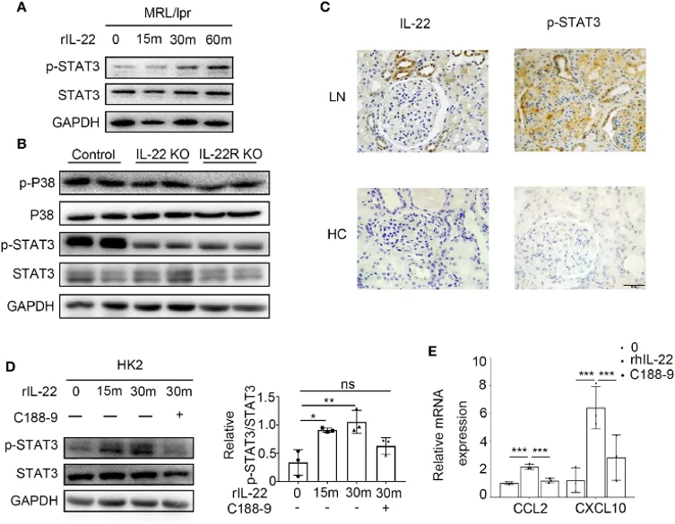 IL-22 promote the expression of CCL2, CXCL10 by activating the STAT3 pathway.