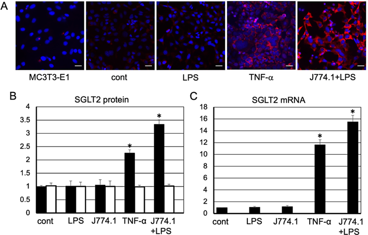 Exacerbation of diabetes due to F. Nucleatum LPS-induced SGLT2 overexpression in the renal proximal tubular epithelial cells.