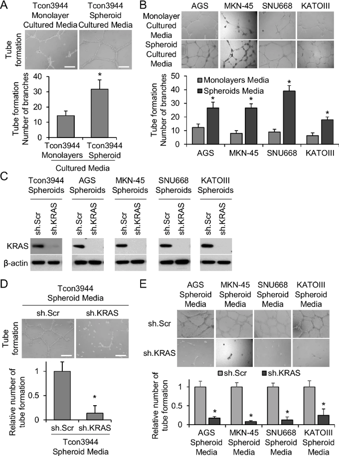 Conditioned media from GA spheroid cells promotes angiogenesis.