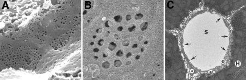 Fig. 1. Structure of mouse liver sinusoidal endothelial cells.