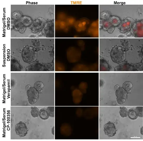 C80 colonies grown in Matrigel/serum accumulate the ABCB1 substrate TMRE in lumens in an ABCB1-dependent manner.