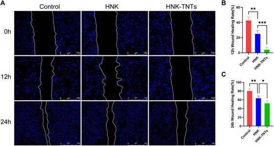 HNK-TNTs inhibited CAL-27 cells migration.