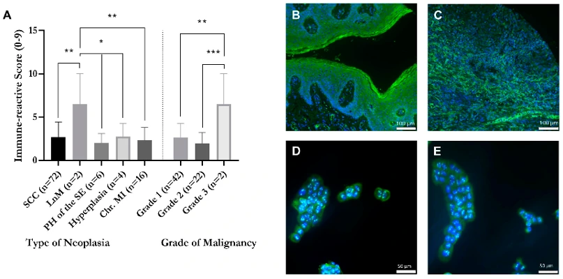 Correlation of GPER1 expression and grade of malignancy within tissue samples of vulvar neoplasia, based on FITC staining (green) of GPER1.