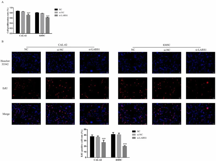 Cell proliferation in difference groups, NC: The cells were treated with normal; si-NC: The cells were transfected with si-NC (negative control); si-LARS1: The cells were transfected with si-LARS1 which inhibitor LARS1 ACell proliferation rate by CCK-8 assay BEdU-positive cell number by EdU staining.