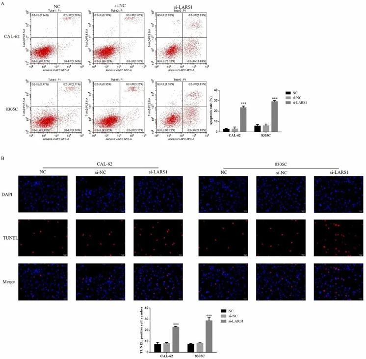 Cell apoptosis in difference groups, NC: The cells were treated with normal; si-NC: The cells were transfected with si-NC (negative control); si-LARS1: The cells were transfected with si-LARS1 which inhibitor LARS1 ACell apoptosis rates in difference groups by flow cytometry BTUNEL positive cell number by TUNEL staining.