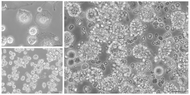 Hepatocytes-KCs co-cultures.