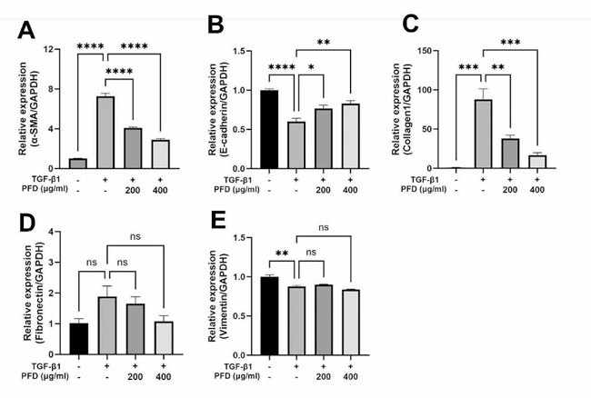 Effects of pirfenidone (PFD) on the TGF-β1 induced mRNA expression of EMT markers and ECM components tested using qPCR.