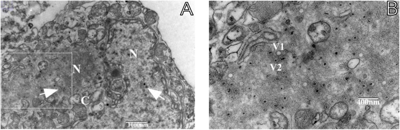 TEM micrographs of CCB infected with KHVisolate GY01 on 18 dpi.
