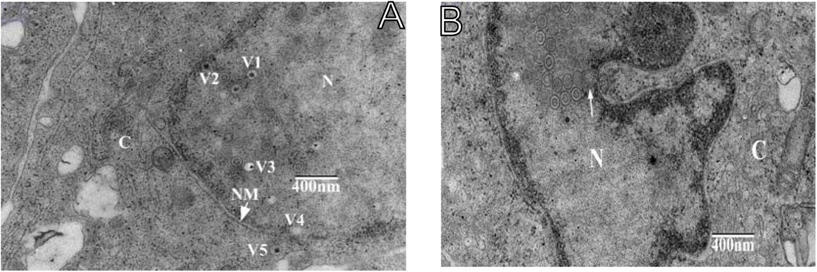 TEM micrographs of CCB infected with KHV isolate GY01 on 18 dpi.