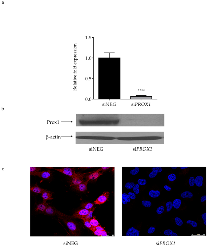 The efficiency of PROX1 knockdown (48 h) with siRNA in CGTH-W-1 cells derived from follicular thyroid cancer (sternal metastasis).