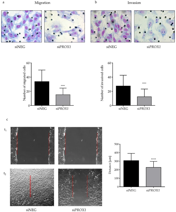 The effect of PROX1 knock-down on the migration (a), invasion (b) and wound healing capacities (c) of CGTH-W-1 follicular thyroid cancer cells determined by Boyden chamber migration, Matrigel invasion and wound-healing assay, respectively.