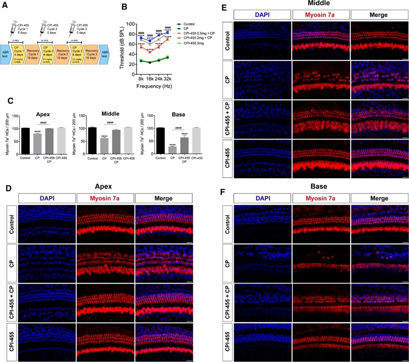 Fig. 2: CPI-455 prevents hearing loss via hair cell protection.