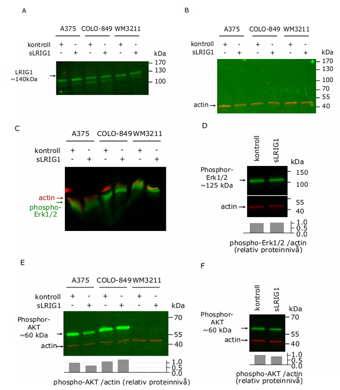 Protein extracts from A375, colo-489, and wm-3211 cell lines, except for Fig. D and F, which show protein extracts from colo-489 cells only. The green signal indicates LRIG1, P-EGFR, P-ERK, or P-AKT, while the red signal indicates actin detected with mouse anti-actin (1:3000) across all cell lines.
