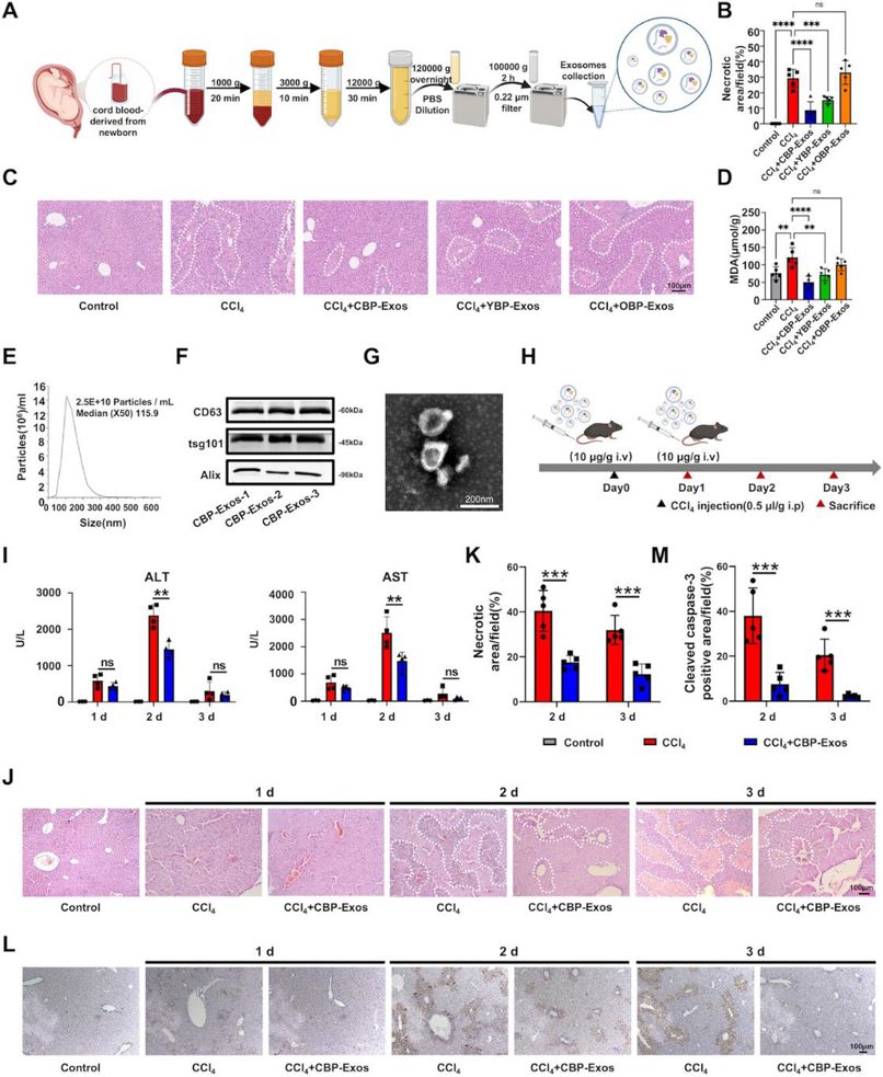 Therapeutic efficacy of exosomes on ALI mice.