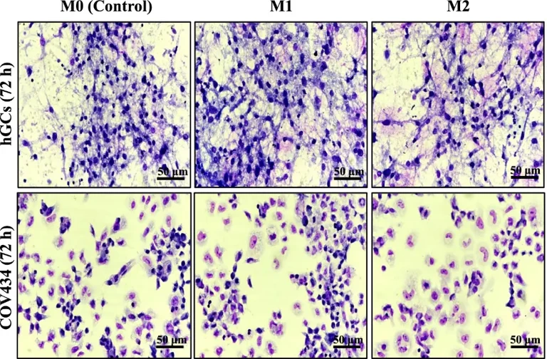 Effects of conditioned media obtained from culture of M1 and M2 macrophages in hGCs and COV434 cells morphology.