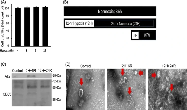 Characterization of exosomes secreted from CTX-TNA2 cells subjected to different hypoxic preconditionings.