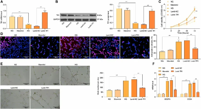 Overexpression of Tff1 inhibits HG-induced mRMEC proliferation and angiogenesis.