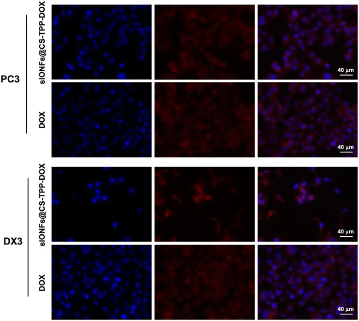 In vitro cellular uptake of sIONFs@CS-TPP-DOX and DOX in PC3 and DX3 cell line.