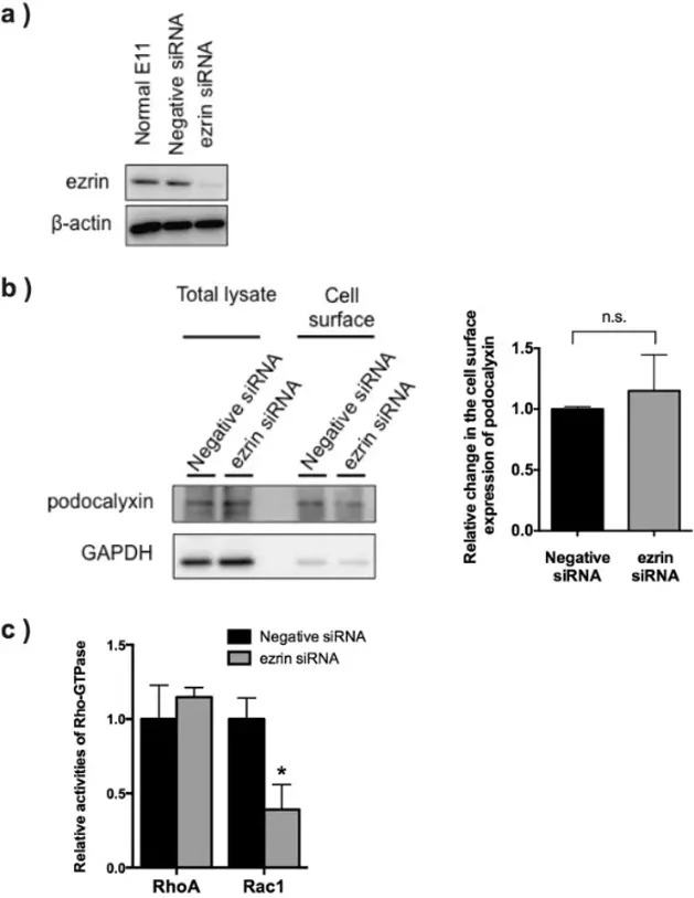 In vitro analysis of surface expression of podocalyxin and Rho-GTPase activity using a podocyte cell line. ERM protein expression levels in E11 cells were investigated by immunoblotting.