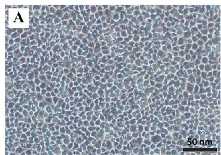 Microscopic examination of epithelioma papulosum cyprini cells.