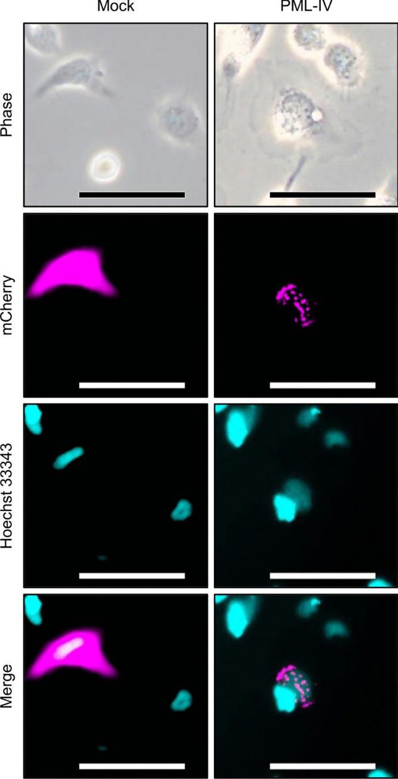 Representative images of morphological changes in EPC cells transiently transfected with mock or PML-IV expression plasmids.
