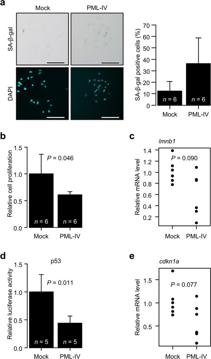 Analysis of selected markers of premature senescence in EPC cells transfected with mock or PML-IV expression plasmids.