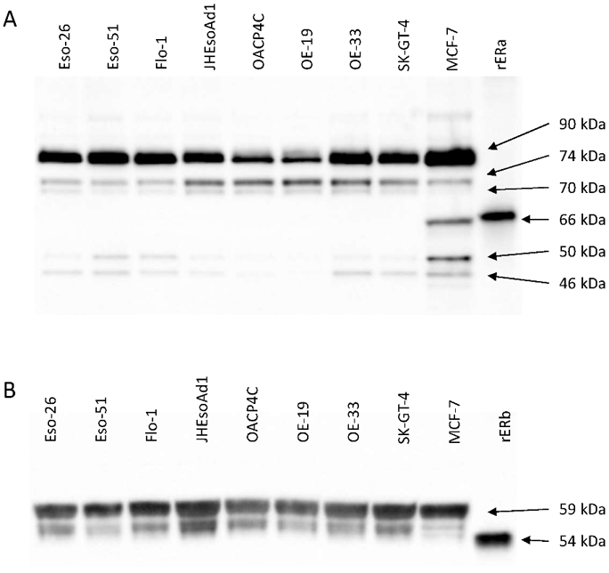 Oestrogen Receptor Expression Patterns in Oesophageal Adenocarcinoma Cell Lines.