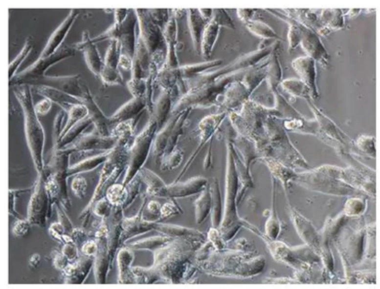 Morphology of G-361 cells.
