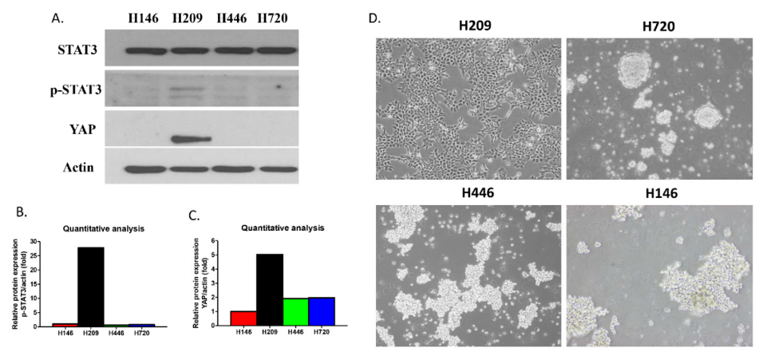 STAT3, p-STAT3 and YAP protein expression and morphology in human small cell lung cancer (SCLC) cell lines.